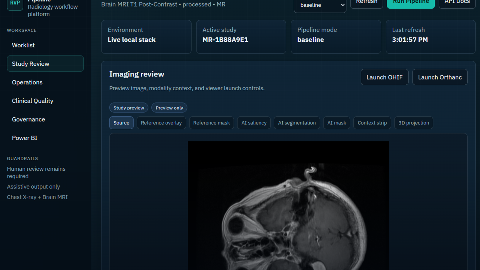 Radiology review workspace showing a brain MRI